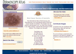 Dermoscopyatlas